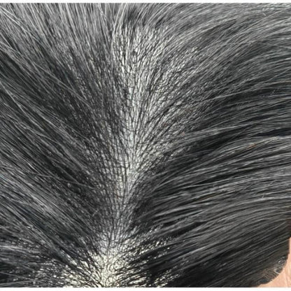 Postiche Homme Cheveux Naturels | Prothése Capillaire Biofilm Ultra - FineCheveux ponpon